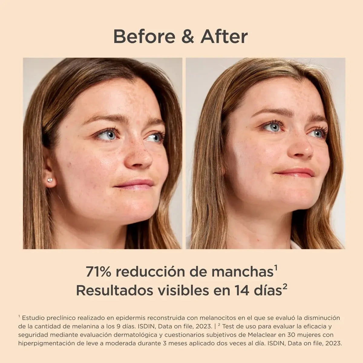 ISDINCEUTICS MELACLEAR  1 FRASCO 30 ML