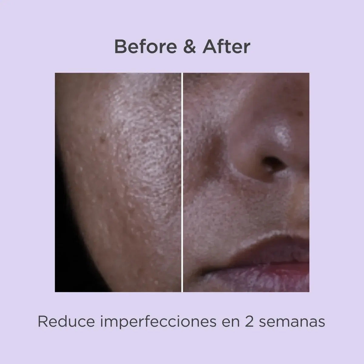 ISDINCEUTICS SALICYLIC RENEWAL 30ML
